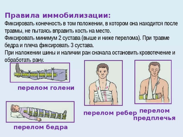 Сколько суставов необходимо зафиксировать при иммобилизации. Перелом основания черепа транспортная иммобилизация.