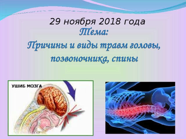 Травмы головы позвоночника и спины обж 9 класс презентация