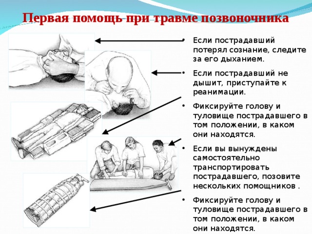 Первая помощь при травме головы картинки