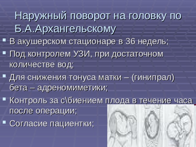 Наружный поворот на головку по Б.А.Архангельскому В акушерском стационаре в 36 недель; Под контролем УЗИ, при достаточном количестве вод; Для снижения тонуса матки – (гинипрал) бета – адреномиметики; Контроль за с\биением плода в течение часа после операции; Согласие пациентки;   