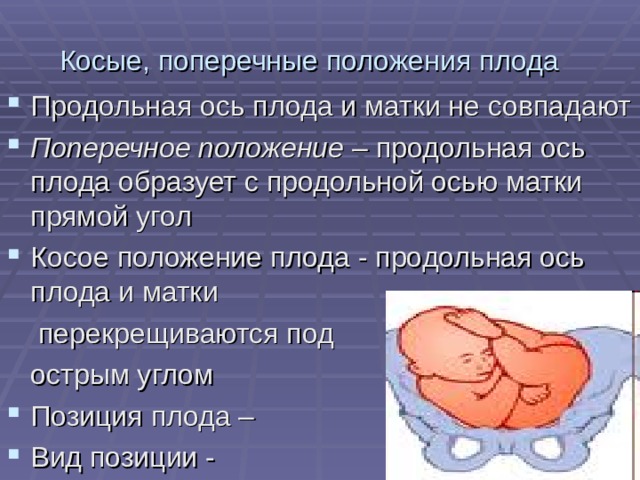 Косые, поперечные положения плода Продольная ось плода и матки не совпадают Поперечное положение – продольная ось плода образует с продольной осью матки прямой угол Косое положение плода - продольная ось плода и матки   перекрещиваются под  острым углом Позиция плода – Вид позиции - 