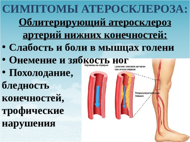 Облитерирующий атеросклероз нижних конечностей карта вызова скорой медицинской помощи