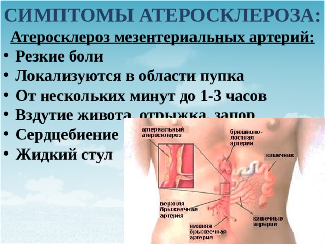 Синдром мезентериальной ишемии презентация