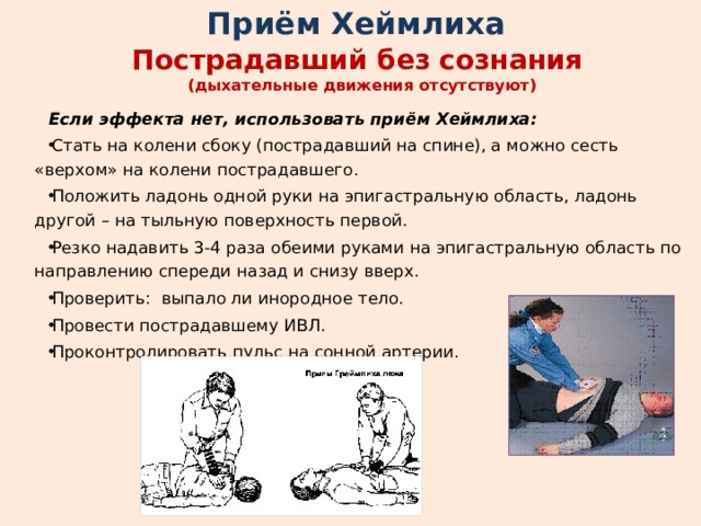 Прием геймлиха презентация