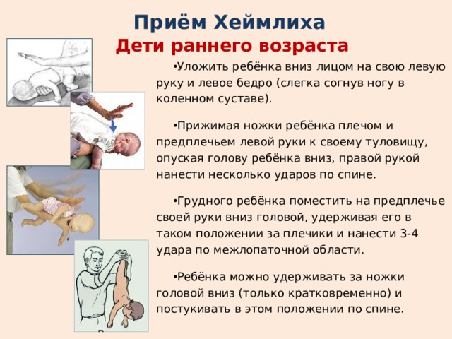 Подавился ребенок карта вызова