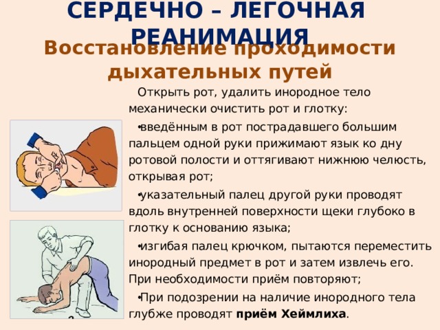 СЕРДЕЧНО – ЛЕГОЧНАЯ РЕАНИМАЦИЯ Восстановление проходимости дыхательных путей Открыть рот, удалить инородное тело механически очистить рот и глотку: введённым в рот пострадавшего большим пальцем одной руки прижимают язык ко дну ротовой полости и оттягивают нижнюю челюсть, открывая рот; указательный палец другой руки проводят вдоль внутренней поверхности щеки глубоко в глотку к основанию языка; изгибая палец крючком, пытаются переместить инородный предмет в рот и затем извлечь его. При необходимости приём повторяют; При подозрении на наличие инородного тела глубже проводят приём Хеймлиха . 