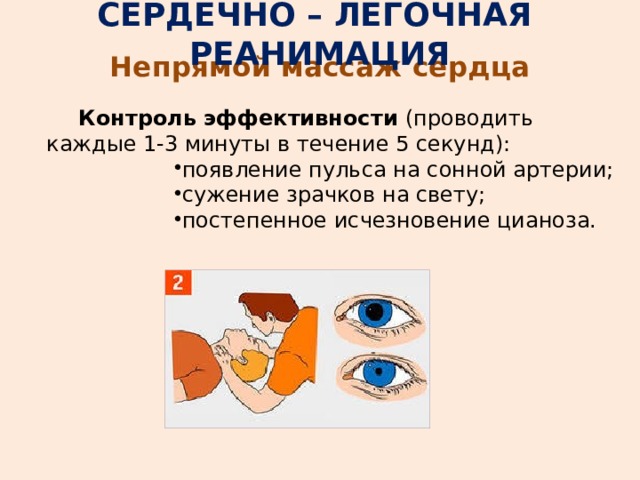 СЕРДЕЧНО – ЛЕГОЧНАЯ РЕАНИМАЦИЯ Непрямой массаж сердца Контроль эффективности (проводить каждые 1-3 минуты в течение 5 секунд): появление пульса на сонной артерии; сужение зрачков на свету; постепенное исчезновение цианоза. появление пульса на сонной артерии; сужение зрачков на свету; постепенное исчезновение цианоза. появление пульса на сонной артерии; сужение зрачков на свету; постепенное исчезновение цианоза. появление пульса на сонной артерии; сужение зрачков на свету; постепенное исчезновение цианоза. 