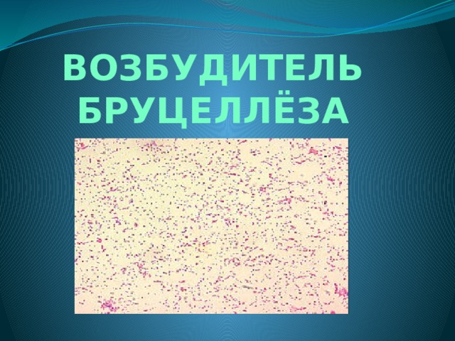 Бруцеллез в атнинском районе. Бруцеллы окраска по Козловскому. Бруцеллы по Козловскому. Бруцеллез возбудитель. Возбудитель бруцеллеза морфология.