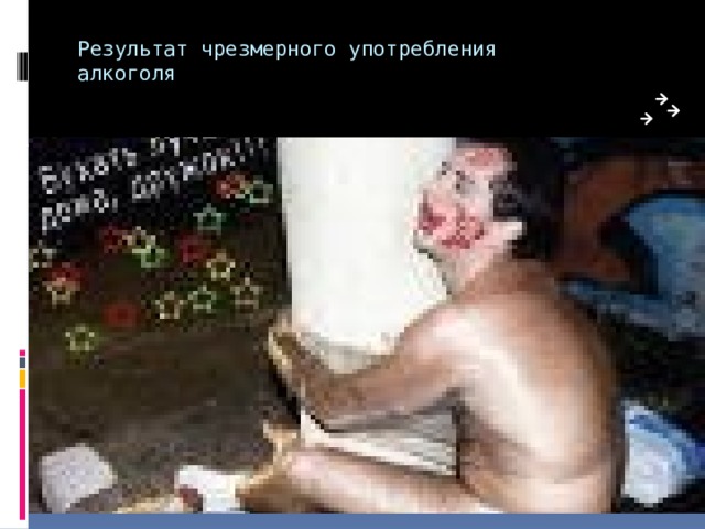 Результат чрезмерного употребления алкоголя 