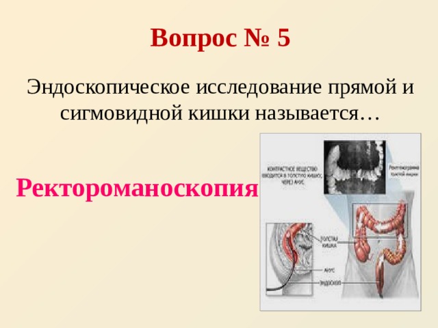 Исследование прямой. Эндоскопическое исследование прямой и сигмовидной кишки это. Исследование прямой и сигмовидной кишки. Ректороманоскопия прямой и сигмовидной кишки. Эндоскопия прямой и сигмовидной кишки.