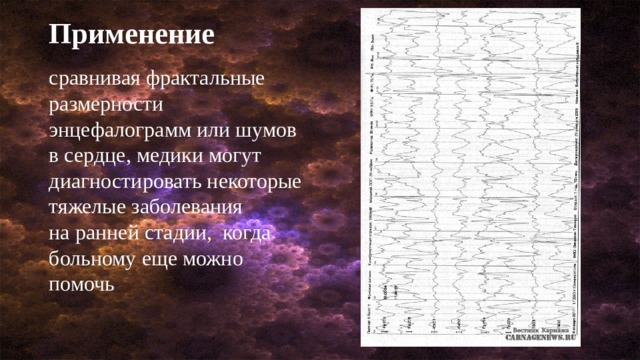 Применение сравнивая фрактальные размерности  энцефалограмм или шумов в сердце, медики могут  диагностировать некоторые тяжелые заболевания  на ранней стадии,  когда больному еще можно  помочь 