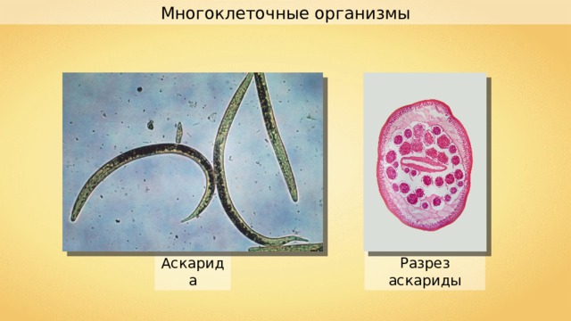 Многоклеточные организмы Аскарида Разрез аскариды 