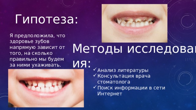 Гипотеза: Я предположила, что здоровье зубов напрямую зависит от того, на сколько правильно мы будем за ними ухаживать. Методы исследования: Анализ литературы Консультация врача стоматолога Поиск информации в сети Интернет 
