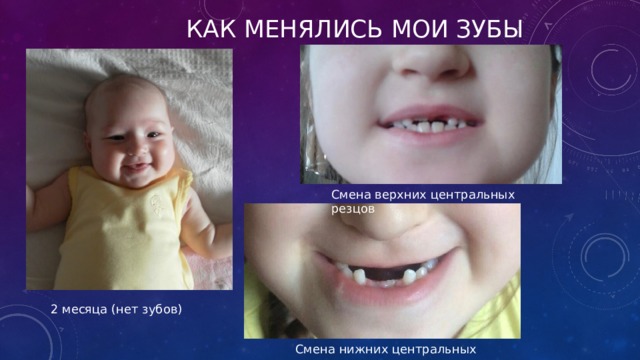               Как менялись мои зубы Смена верхних центральных резцов 2 месяца (нет зубов) Смена нижних центральных резцов 