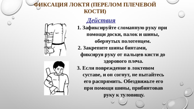 Открытый перелом плечевой кости карта вызова