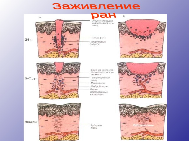 Как выглядят швы на руке Виды ран, оказание первой доврачебной помощи