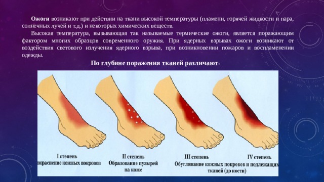 Презентация первая помощь при воздействии высоких температур