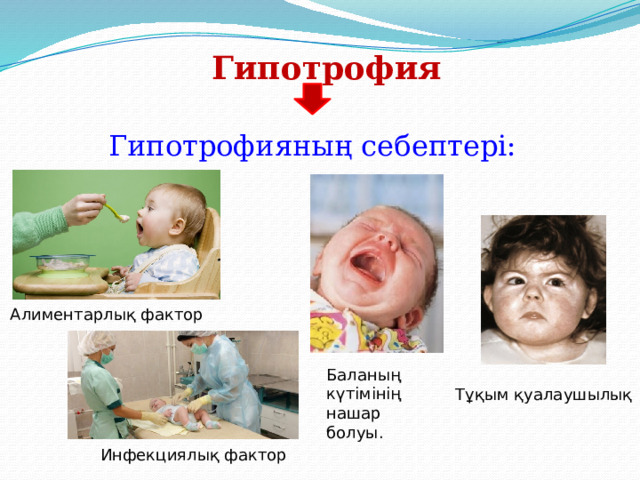 Гипотрофия Гипотрофияның себептері: Алиментарлық фактор Баланың күтімінің нашар болуы. Тұқым қуалаушылық Инфекциялық фактор 