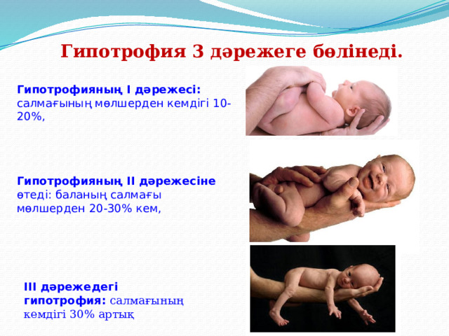 Гипотрофия 3 дәрежеге бөлінеді. Гипотрофияның I дәрежесі: салмағының мөлшерден кемдігі 10-20%, Гипотрофияның II дәрежесіне өтеді: баланың салмағы мөлшерден 20-30% кем, III дәрежедегі гипотрофия: салмағының кемдігі 30% артық 