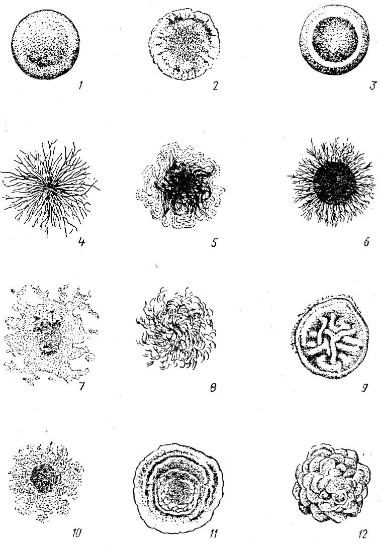 Формы колоний. Профиль колоний микроорганизмов. Формы колоний микроорганизмов. Формы колоний микробиология. Ризоидная форма бактерий.