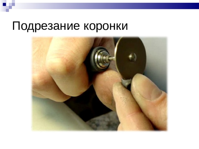 Подрезание коронки 