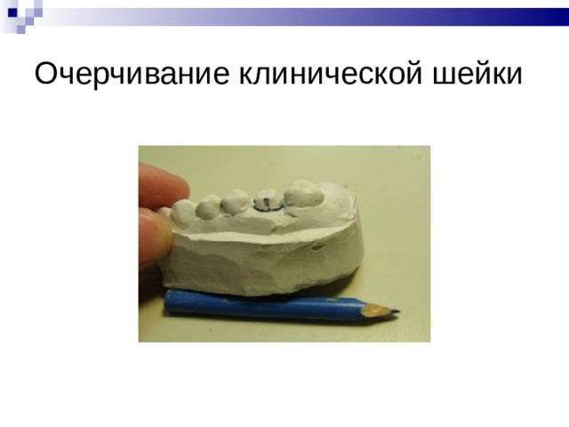 Очерчивание клинической шейки 