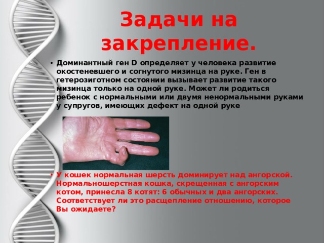 Задачи на закрепление. Доминантный ген D определяет у человека развитие окостеневшего и согнутого мизинца на руке. Ген в гетерозиготном состоянии вызывает развитие такого мизинца только на одной руке. Может ли родиться ребенок с нормальными или двумя ненормальными руками у супругов, имеющих дефект на одной руке     У кошек нормальная шерсть доминирует над ангорской. Нормальношерстная кошка, скрещенная с ангорским котом, принесла 8 котят: 6 обычных и два ангорских. Соответствует ли это расщепление отношению, которое Вы ожидаете? 