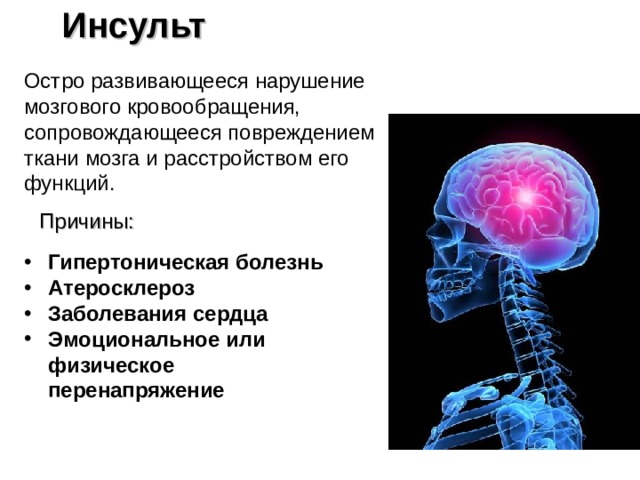 Инсульт Остро развивающееся нарушение мозгового кровообращения, сопровождающееся повреждением ткани мозга и расстройством его функций. Причины: Гипертоническая болезнь Атеросклероз Заболевания сердца Эмоциональное или физическое перенапряжение  