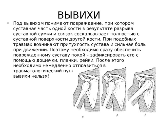 Припухлость сустава пальца руки. Опух и болит сустав на пальце руки: что делать и как лечить Что такое туннельный синдром пальцев руки фото Бурсит кисти и пальцев рук: причины, симптомы и лечение
