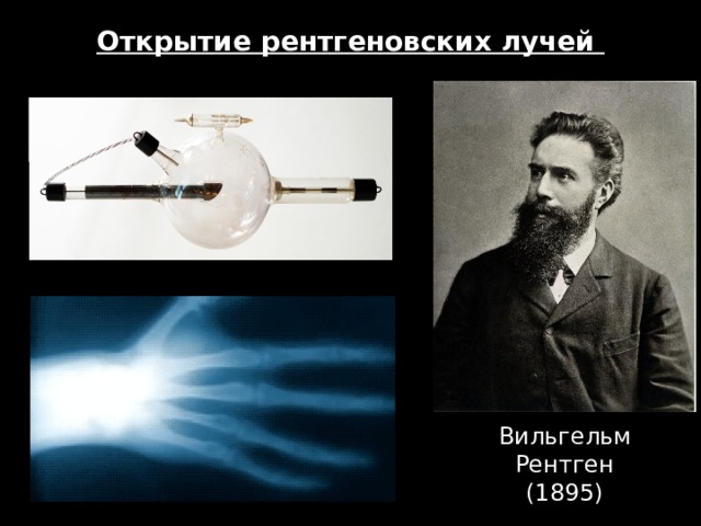 Открытие рентгеновских лучей Вильгельм Рентген  (1895)  