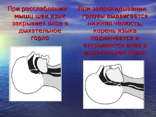 Запрокидывание головы назад. Расслабляющие мышцы гортани. Мышцы, обеспечивающие запрокидывание головы: