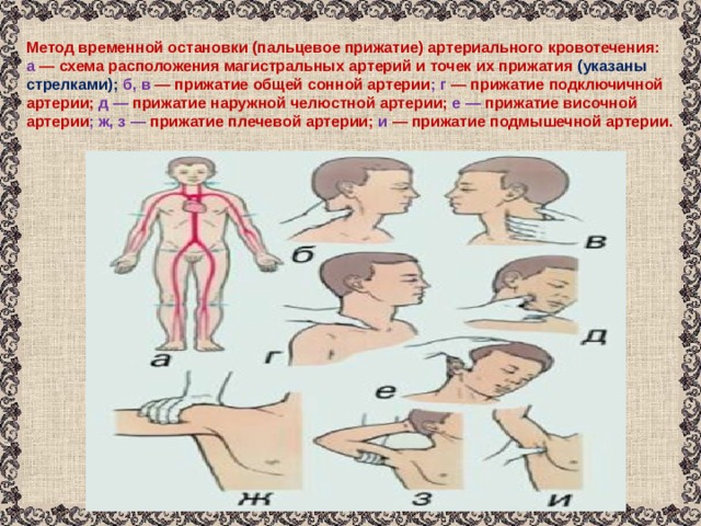 Как производится пальцевое прижатие подключичной артерии. Пальцевое прижатие подключичной артерии. Точки прижатия артерий для остановки кровотечения.