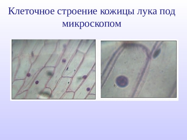 Клеточное строение кожицы лука под микроскопом 