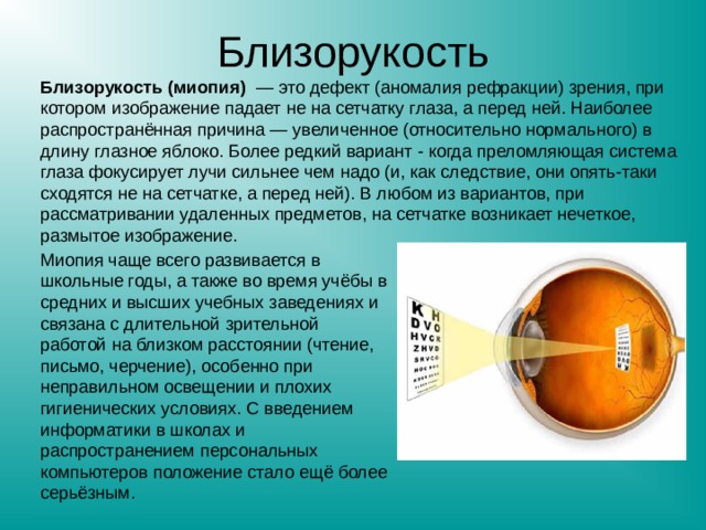 Близорукость Близорукость (миопия) — это дефект (аномалия рефракции) зрения, при котором изображение падает не на сетчатку глаза, а перед ней. Наиболее распространённая причина — увеличенное (относительно нормального) в длину глазное яблоко. Более редкий вариант - когда преломляющая система глаза фокусирует лучи сильнее чем надо (и, как следствие, они опять-таки сходятся не на сетчатке, а перед ней). В любом из вариантов, при рассматривании удаленных предметов, на сетчатке возникает нечеткое, размытое изображение. Миопия чаще всего развивается в школьные годы, а также во время учёбы в средних и высших учебных заведениях и связана с длительной зрительной работой на близком расстоянии (чтение, письмо, черчение), особенно при неправильном освещении и плохих гигиенических условиях. С введением информатики в школах и распространением персональных компьютеров положение стало ещё более серьёзным. 