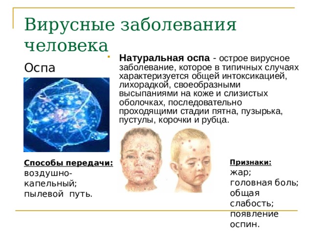 Вирусные заболевания человека  Натуральная оспа - острое вирусное заболевание, которое в типичных случаях характеризуется общей интоксикацией, лихорадкой, своеобразными высыпаниями на коже и слизистых оболочках, последовательно проходящими стадии пятна, пузырька, пустулы, корочки и рубца. Оспа Признаки : Способы передачи : воздушно-капельный; пылевой путь. жар; головная боль; общая слабость; появление оспин. 