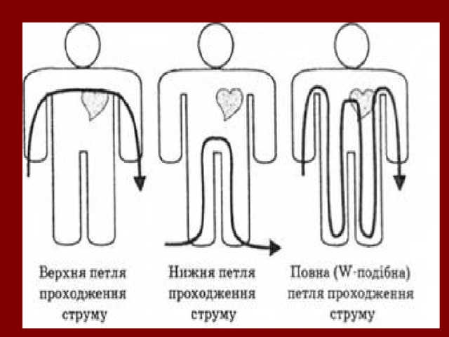 Проект на тему вплив електричного струму на організм людини