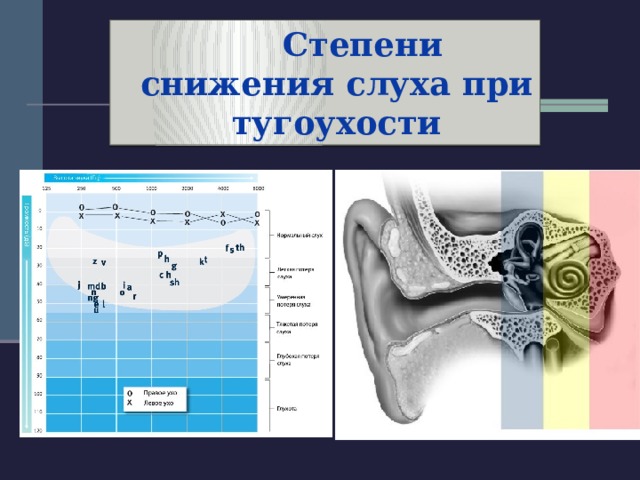 Степени слуха