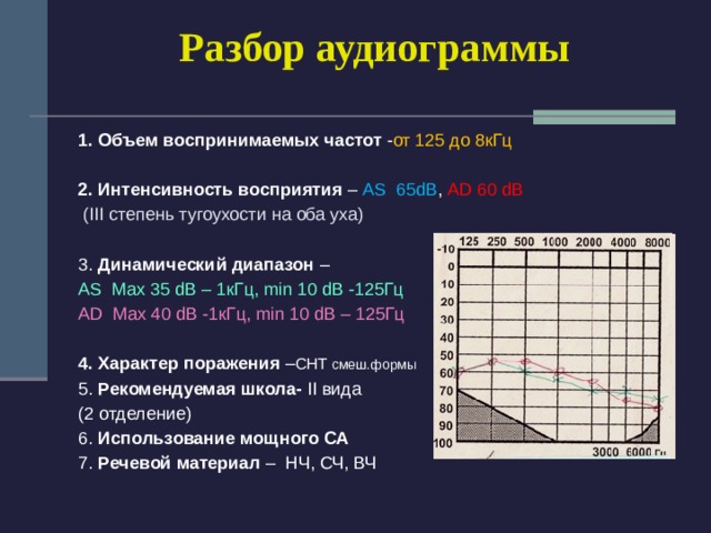 Аудиограмма слуха что это. Аудиограмма 3 степени тугоухости. Аудиограмма 4 степени тугоухости. Нейросенсорная тугоухость 3 степени аудиограмма. Кондуктивная тугоухость 3 степени аудиограмма.