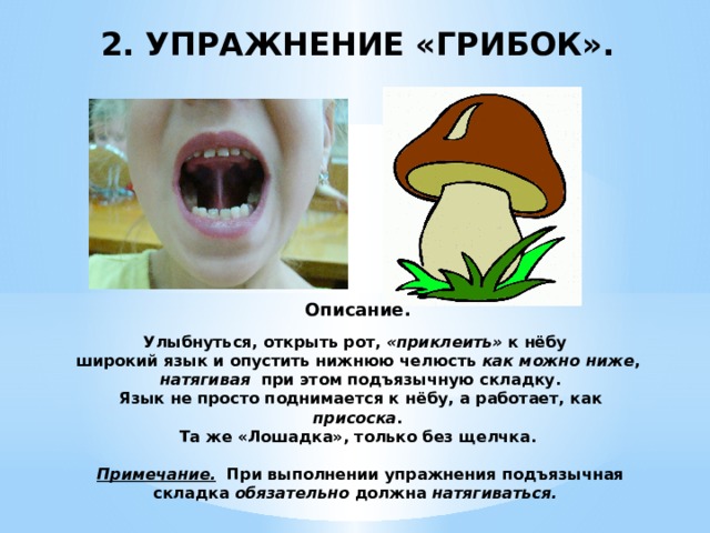 2. УПРАЖНЕНИЕ «ГРИБОК».         Описание.   Улыбнуться, открыть рот, «приклеить» к нёбу  широкий язык и опустить нижнюю челюсть как можно ниже ,   натягивая при этом подъязычную складку.  Язык не просто поднимается к нёбу, а работает, как присоска .  Та же «Лошадка», только без щелчка.    Примечание. При выполнении упражнения подъязычная складка обязательно должна натягиваться.     