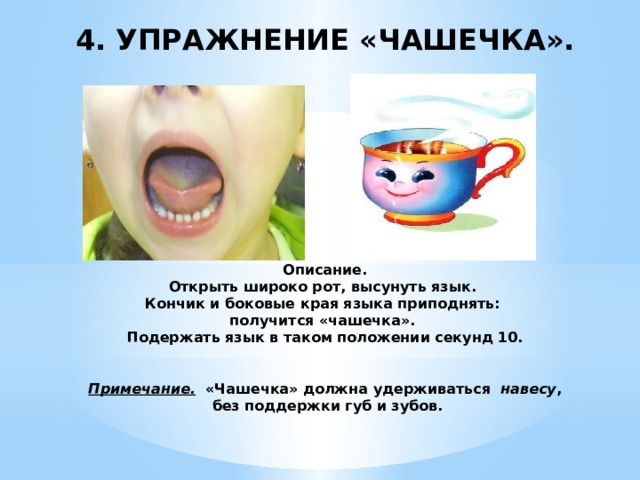 4. УПРАЖНЕНИЕ «ЧАШЕЧКА».        Описание.  Открыть широко рот, высунуть язык.  Кончик и боковые края языка приподнять:  получится «чашечка».  Подержать язык в таком положении секунд 10.    Примечание. «Чашечка» должна удерживаться навесу ,  без поддержки губ и зубов.   