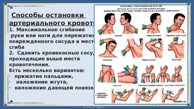 Какой способ остановки артериального кровотечения