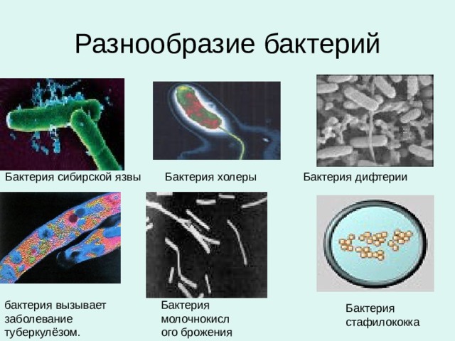 Разнообразие бактерий Бактерия сибирской язвы Бактерия холеры Бактерия дифтерии бактерия вызывает заболевание туберкулёзом. Бактерия молочнокислого брожения Бактерия стафилококка 