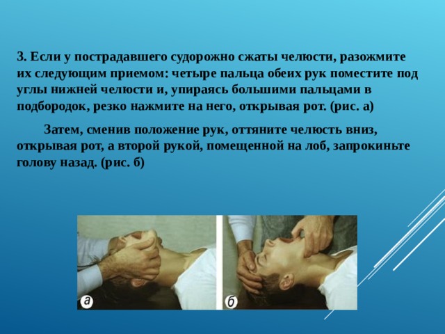 3. Если у пострадавшего судорожно сжаты челюсти, разожмите их следующим приемом: четыре пальца обеих рук поместите под углы нижней челюсти и, упираясь большими пальцами в подбородок, резко нажмите на него, открывая рот. (рис. а)  Затем, сменив положение рук, оттяните челюсть вниз, открывая рот, а второй рукой, помещенной на лоб, запрокиньте голову назад. (рис. б) 