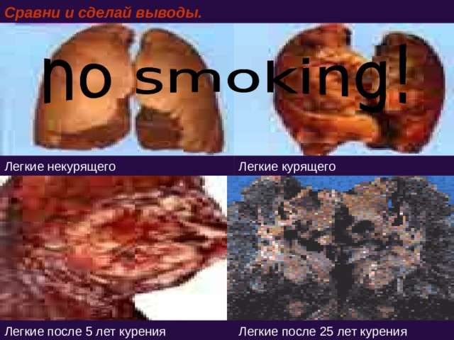Сравни и сделай выводы. Легкие некурящего Легкие курящего Легкие после 5 лет курения Легкие после 25 лет курения 