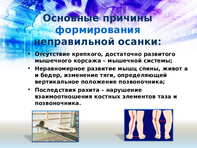 Основные причины формирования неправильной осанки: Отсутствие крепкого, достаточно развитого мышечного корсажа – мышечной системы; Неравномерное развитие мышц спины, живот а и бедер, изменение тяги, определяющей вертикальное положение позвоночника; Последствия рахита – нарушение взаимоотношения костных элементов таза и позвоночника.  