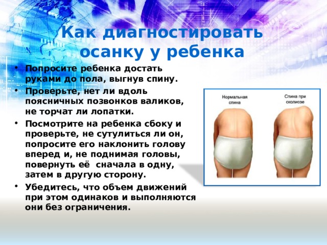 Как диагностировать осанку у ребенка Попросите ребенка достать руками до пола, выгнув спину. Проверьте, нет ли вдоль поясничных позвонков валиков, не торчат ли лопатки. Посмотрите на ребенка сбоку и проверьте, не сутулиться ли он, попросите его наклонить голову вперед и, не поднимая головы, повернуть её сначала в одну, затем в другую сторону. Убедитесь, что объем движений при этом одинаков и выполняются они без ограничения.  
