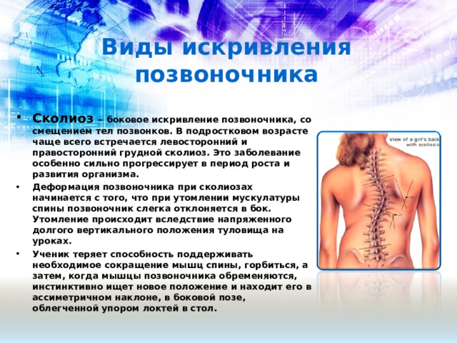 Виды искривления позвоночника Сколиоз – боковое искривление позвоночника, со смещением тел позвонков. В подростковом возрасте чаще всего встречается левосторонний и правосторонний грудной сколиоз . Это заболевание особенно сильно прогрессирует в период роста и развития организма. Деформация позвоночника при сколиозах начинается с того, что при утомлении мускулатуры спины позвоночник слегка отклоняется в бок. Утомление происходит вследствие напряженного долгого вертикального положения туловища на уроках. Ученик теряет способность поддерживать необходимое сокращение мышц спины, горбиться, а затем, когда мышцы позвоночника обременяются, инстинктивно ищет новое положение и находит его в ассиметричном наклоне, в боковой позе, облегченной упором локтей в стол.    