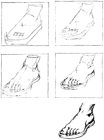 Гипс ноги рисунок