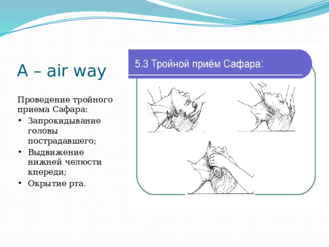 А – air way Проведение тройного приема Сафара: Запрокидывание головы пострадавшего; Выдвижение нижней челюсти кпереди; Окрытие рта. 