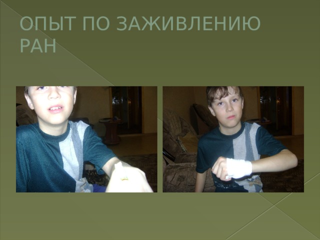 ОПЫТ ПО ЗАЖИВЛЕНИЮ РАН 